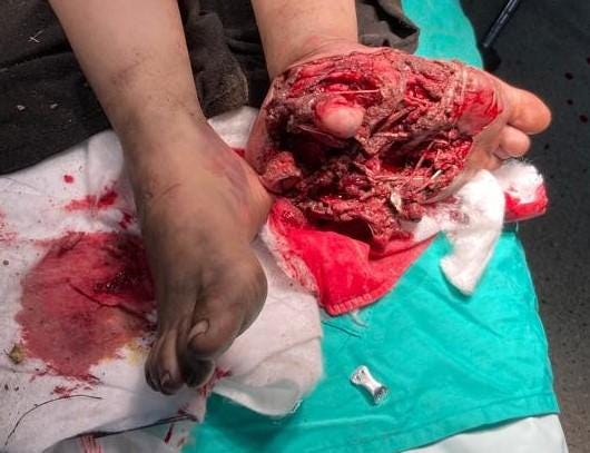 C:\Users\Felix Abt\Downloads\gore\IMG-20240128-WA0026a.jpg C:\Users\Felix Abt\Downloads\gore\IMG-20240128-WA0026a.jpg
