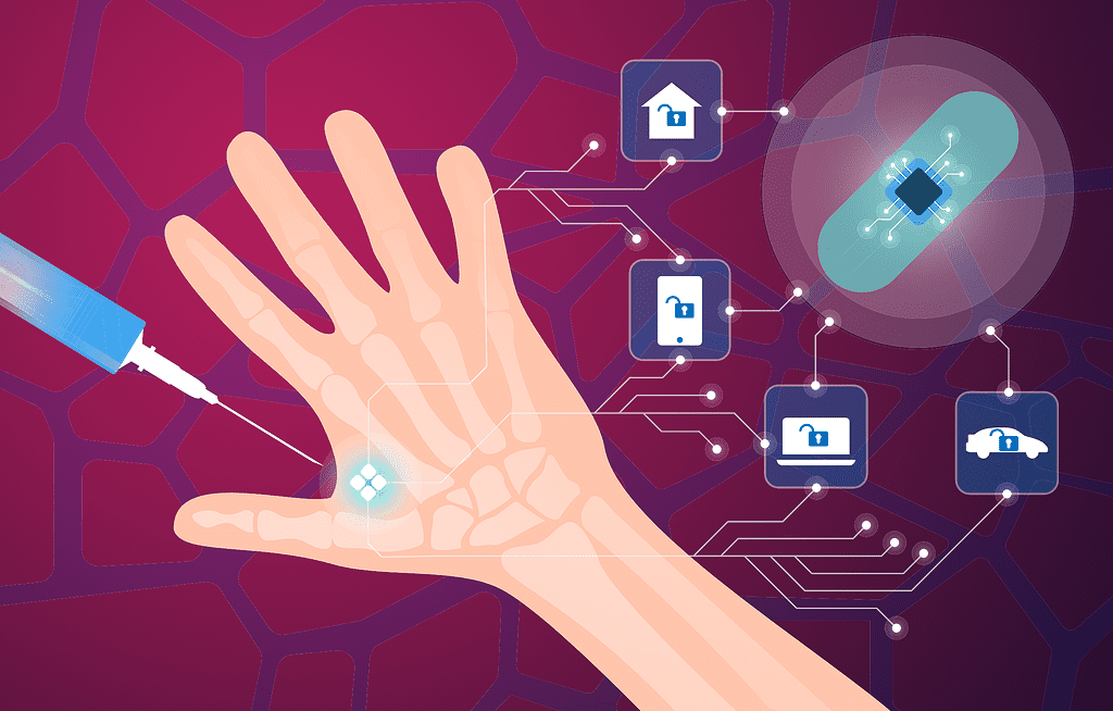 Right Hand Microchip: Mark of the Beast