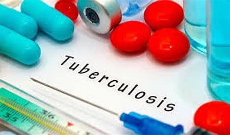 Image result for tubaculosis