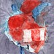 Heart Block