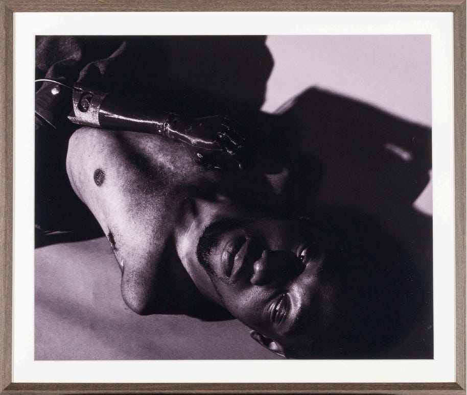 A framed digital photo of a young Black disabled man with a prosthetic arm lying on his chest.
