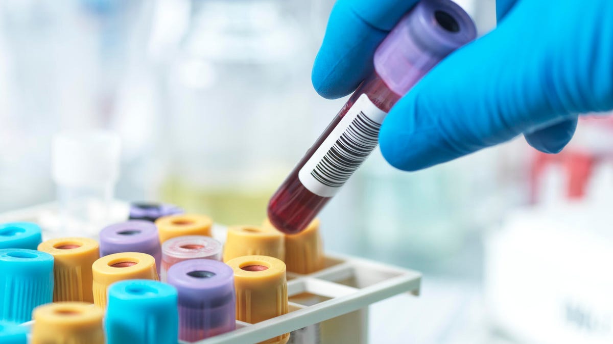 6 Blood Tests That Can Tell You How Your Body Is Functioning - CNET