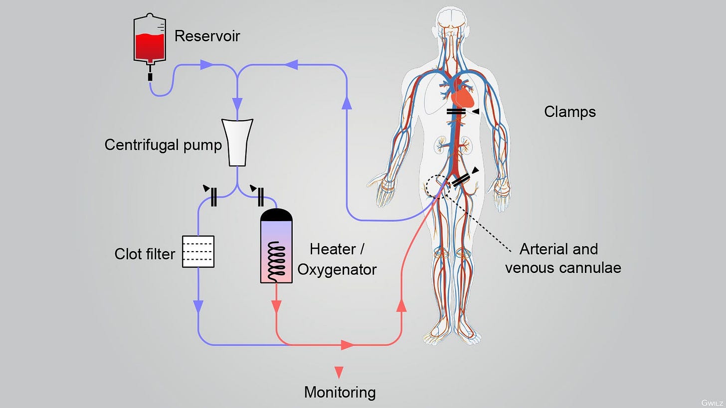 ACP: Pump the Brakes on New Organ Procurement Method ...