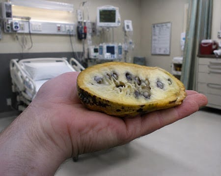 pawpaw-fruit