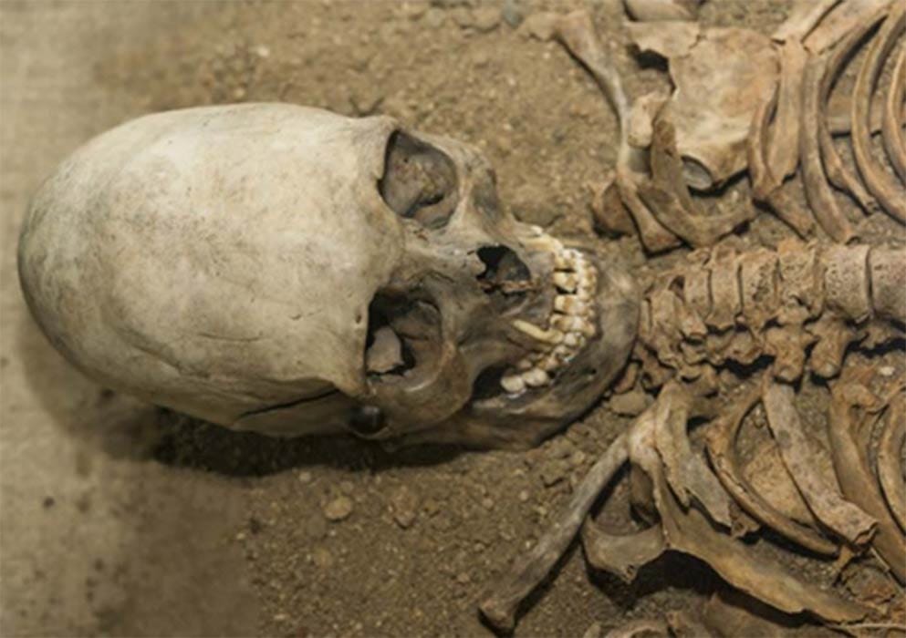An elongated skull ( gerasimov174 / Adobe Stock)