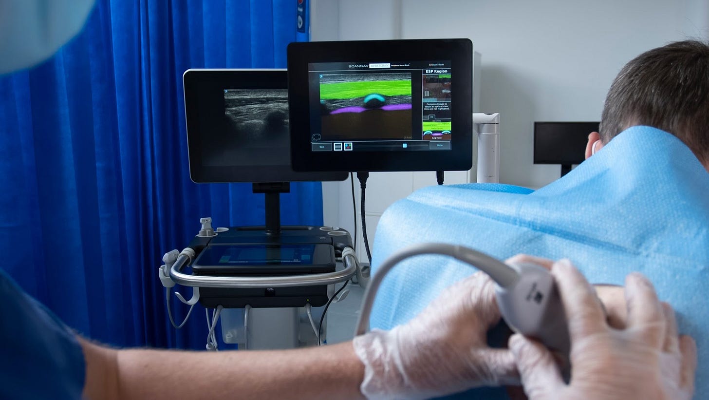 ScanNav Anatomy Peripheral Nerve Block (PNB) - Intelligent Ultrasound