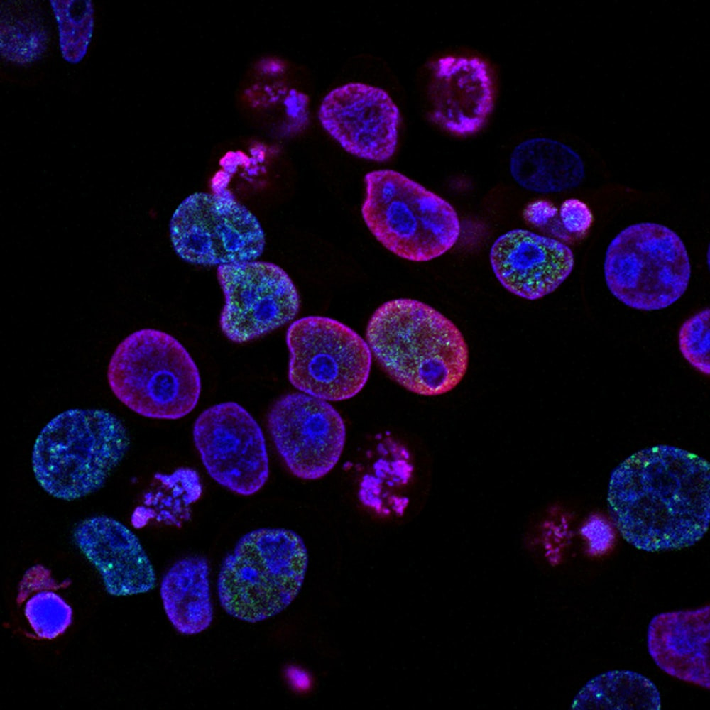 purple cells purple cells