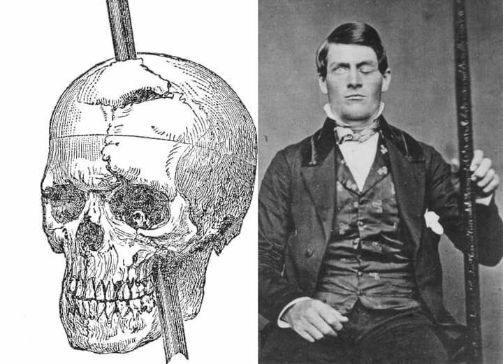 This may contain: an image of a man with a skull on his head and another drawing of a human skull