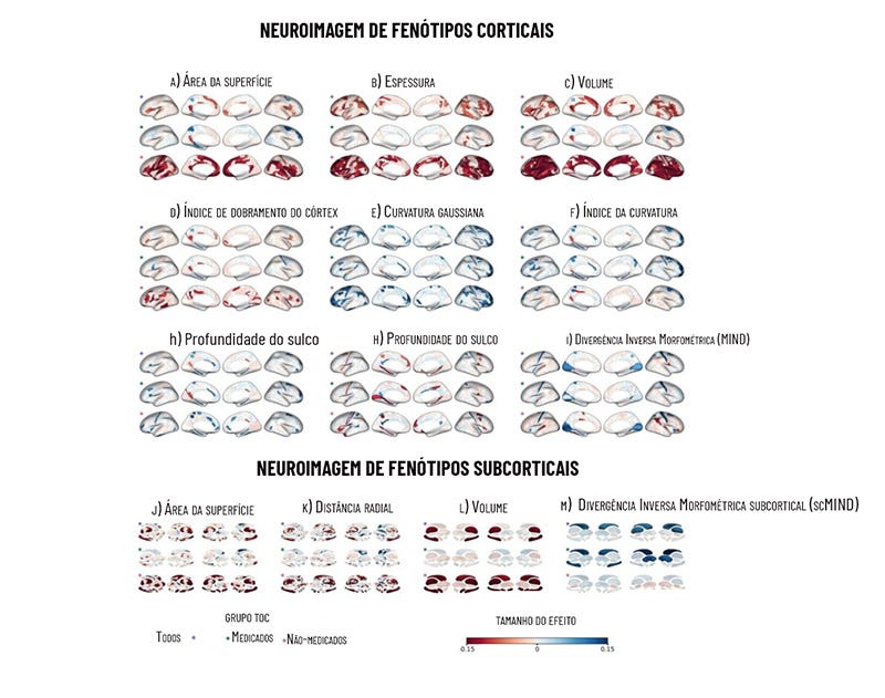 Desenho de cérebros em branco com marcações em vermelho e azul indicando diferenças na região cortical e subcortical Desenho de cérebros em branco com marcações em vermelho e azul indicando diferenças na região cortical e subcortical