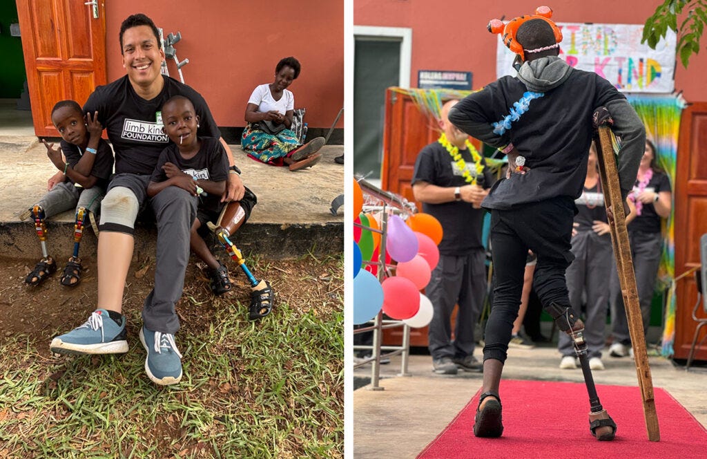 Two panel photo. Left: Hayden Hatch with two children with prosthetics legs; right: a person with prosthetic leg walks supported by a crutch.