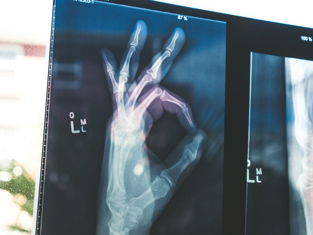 citiscan result hand ok