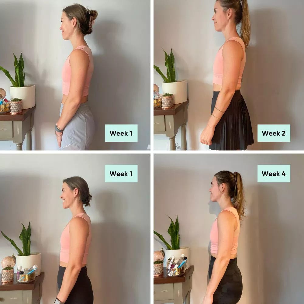 Forme Bra Review: Before and After Photos Forme Bra Review: Before and After Photos