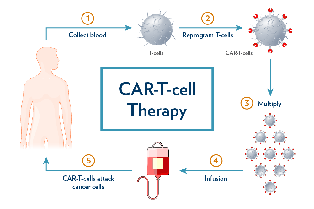 Research project aims to make CAR-T-cell therapy safer and more effective |  College of Medicine | MUSC