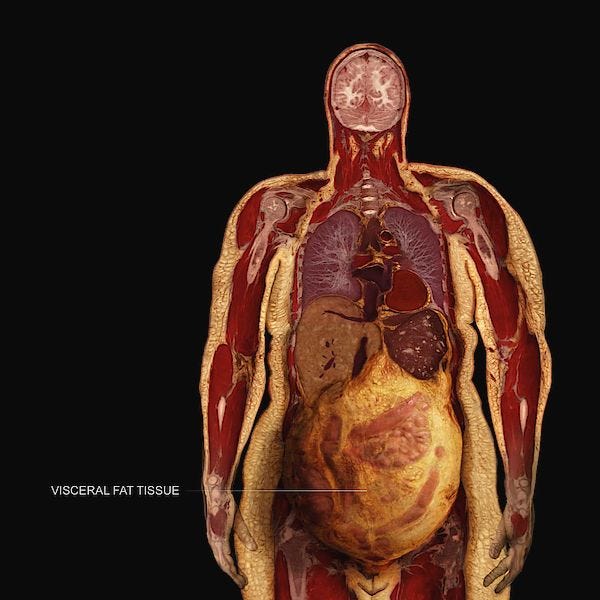 This may contain: an image of the inside of a human body