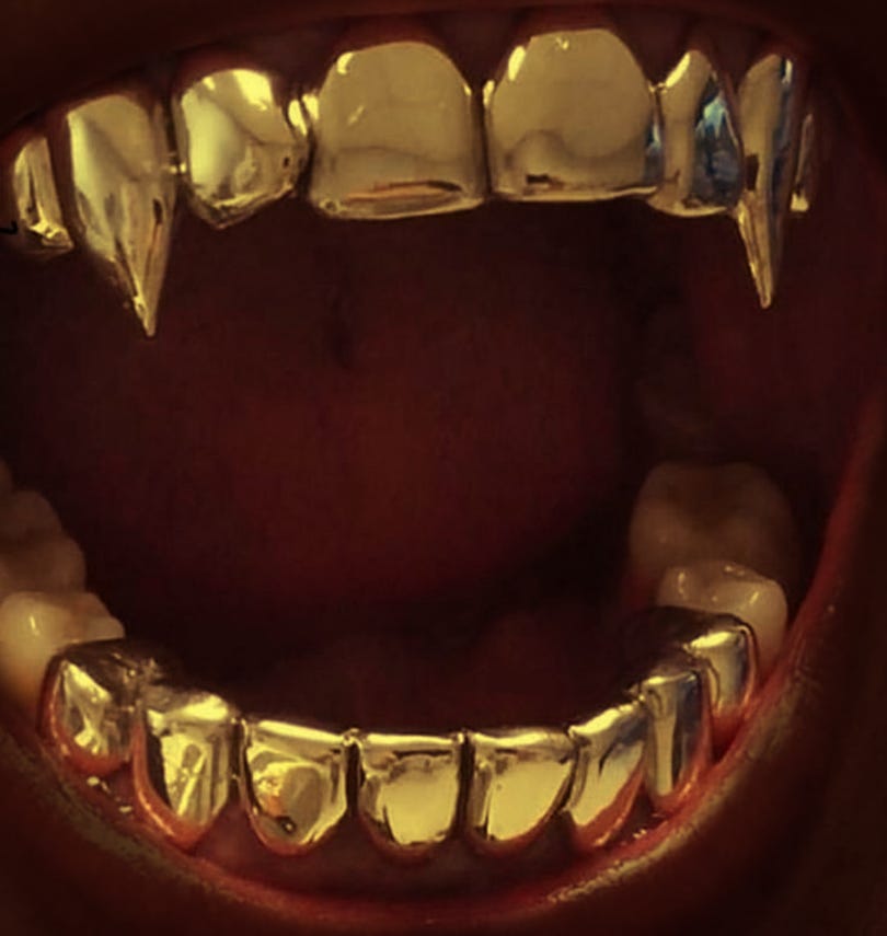 The image shows a close-up view of a person's teeth, showcasing the shiny, metal braces.
AI-generated content may be incorrect. The image shows a close-up view of a person's teeth, showcasing the shiny, metal braces.
AI-generated content may be incorrect.