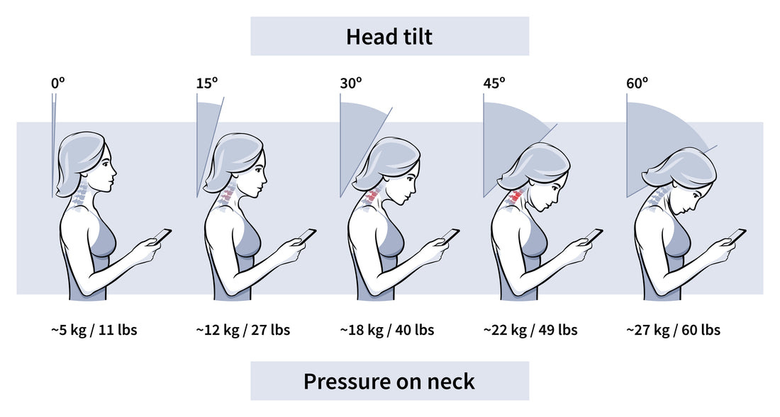 Text Neck – Schneider Clinic