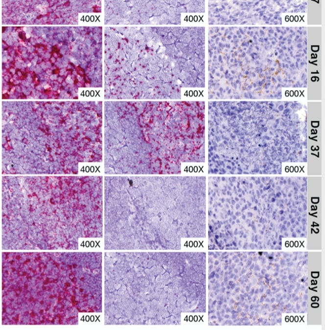 A Health Public Policy Nightmare 