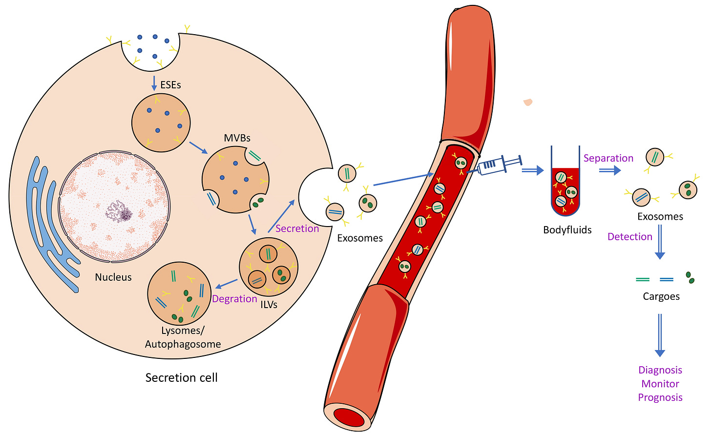 Exosomes in Liquid Biopsy: A Nanotool for Postradiotherapy Cancer Monitoring