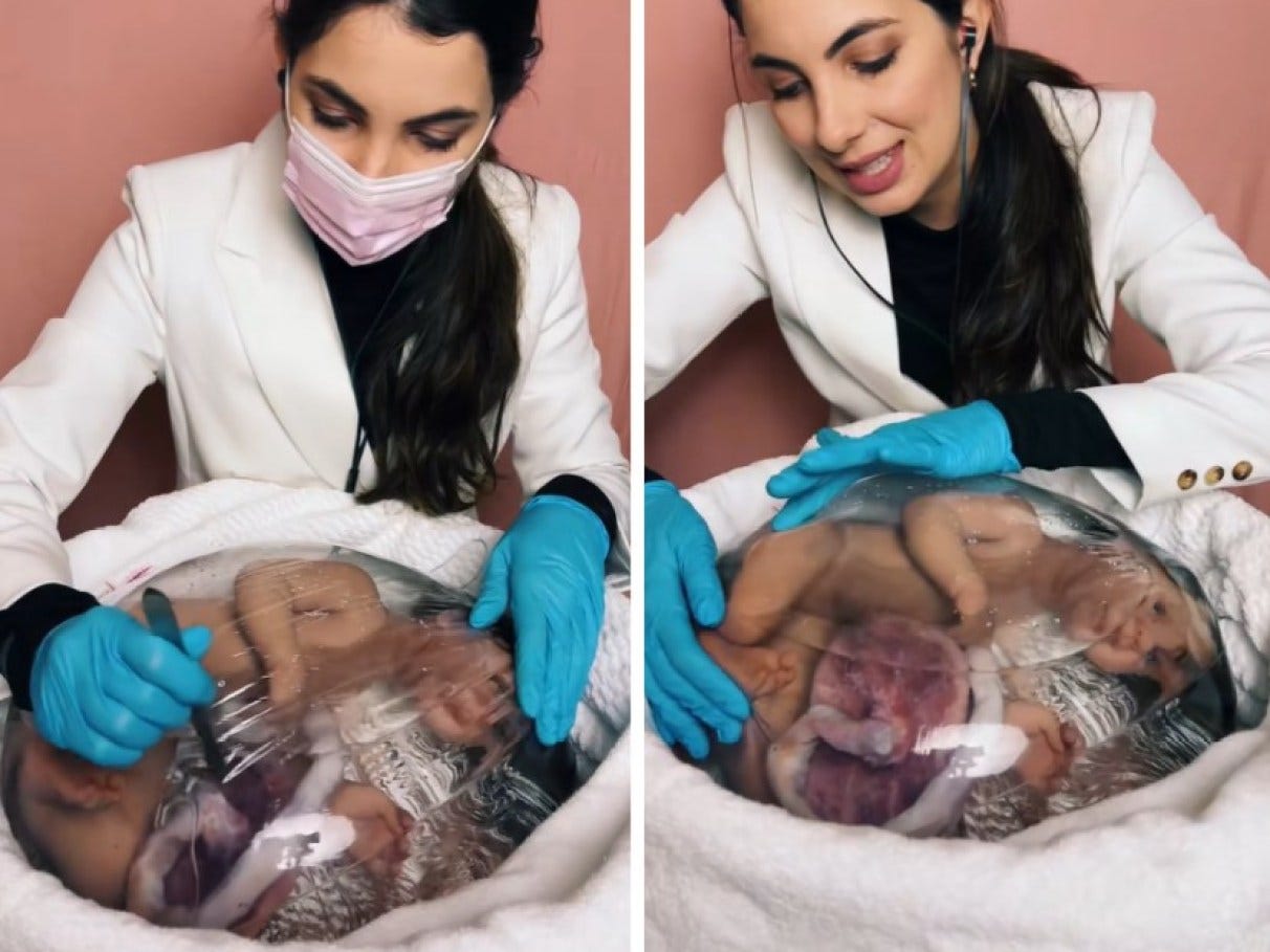 Mães de bebê reborn': o limite do bom senso no us... | VEJA