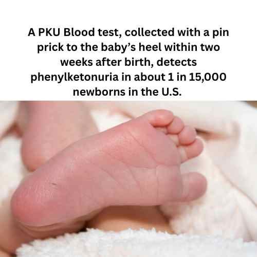 Heel Prick Blood Test for Detecting PKU in infants Heel Prick Blood Test for Detecting PKU in infants