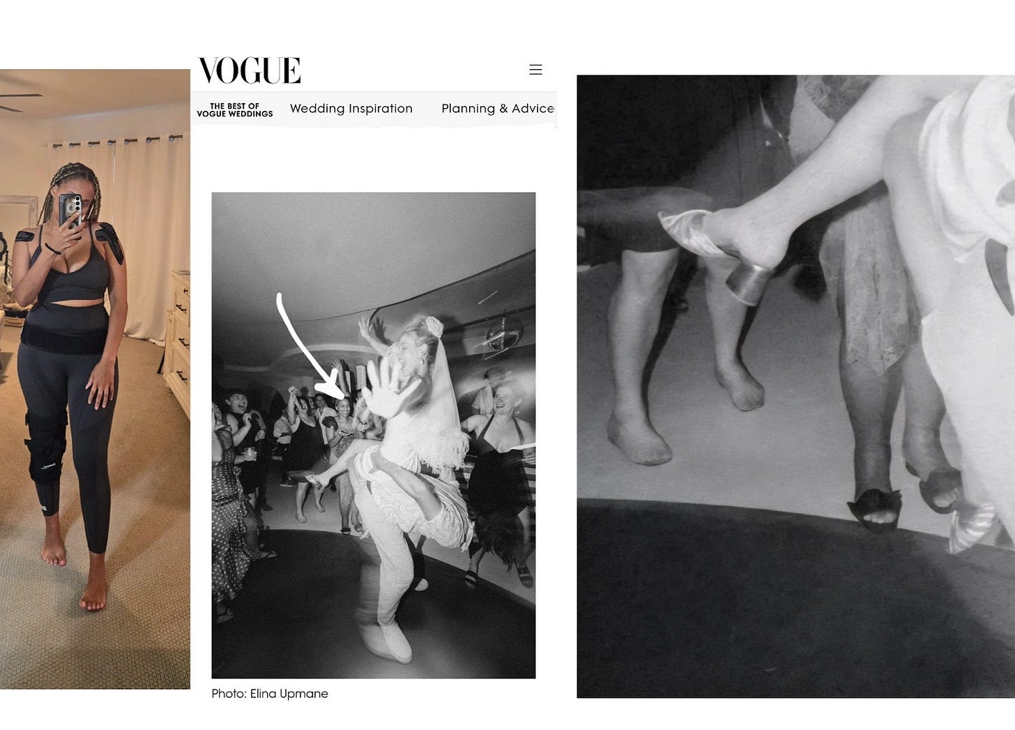In a series Dr. Cadet stands in front of a mirror in a dark gray sports bra and matching leggings wearing black kineso tape on her shoulders, a black back brace belt, and black knee brace. The second picture is a screenshot of Dr. Cadet in Vogue for a wedding she attended in Italy. The black and white image has the bride front and center on her husband's back dancing joyously while Dr. Cadet is in the background smiling and clapping amongst the guests on the dance floor. The final black and white picture is a close up of the Vogue picture showing just how swollen Dr. Cadet’s ankles/feet are as she was unable to wear the heels she wanted too.