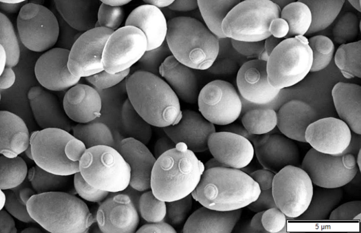 Saccharomycetes - Wikipedia, la enciclopedia libre