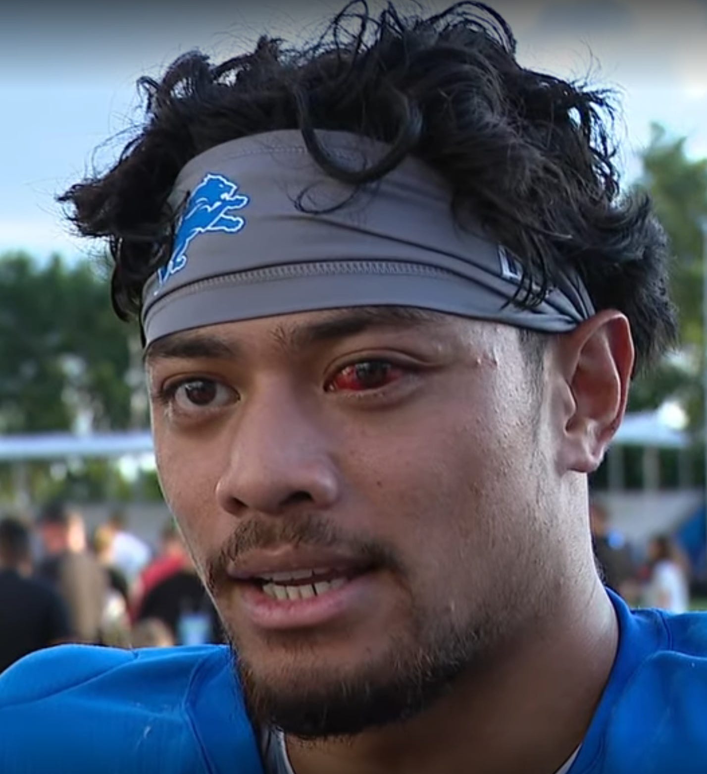 Sione Vaki eye injury Detroit Lions Sione Vaki eye injury Detroit Lions