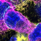 The mass death of immune cells 10 months after Covid infection 
