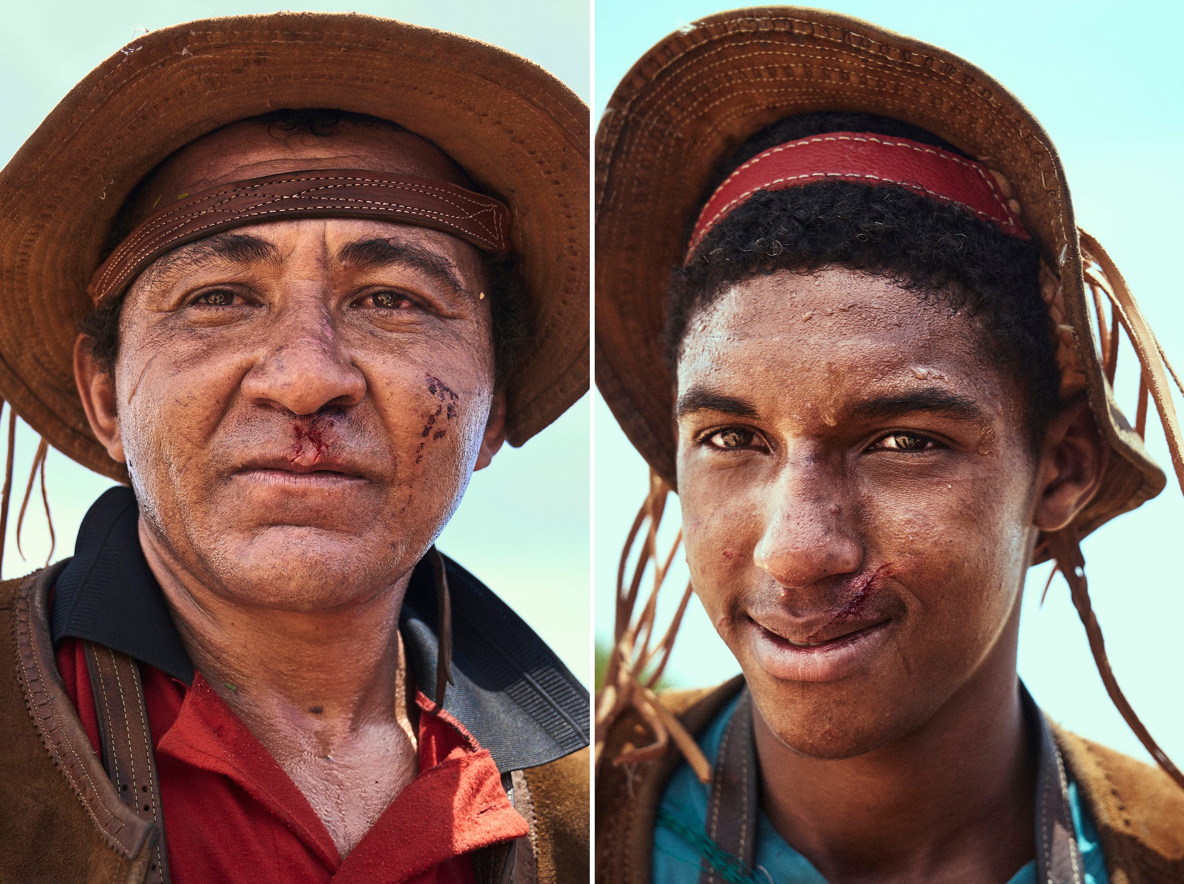 Two men wearing wide-brimmed hats and leather straps have facial injuries and serious expressions. The older man on the left has a wounded lip and cheek, while the younger man on the right has a cut on his upper lip.