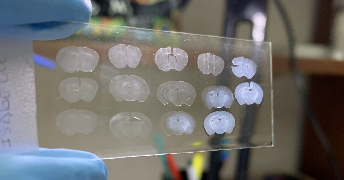 Lâmina com cortes das regiões cerebrais dos animais estudadas mostrando o resultado dos procedimentos com imunofluorescência para identificar os neurônios GnRH e astrócitos