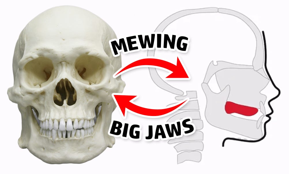 Mewing Injury 2.6 The Mewing Catch-22 - by Ronald Ead - JawHacks
