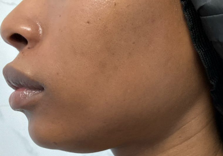 Day 401: Barrier repair + my new product obsession
