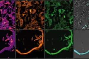 Chemical imaging of active gut microbes