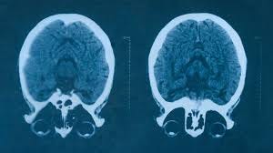 Neural Harmony: Syncing the Brain to ...