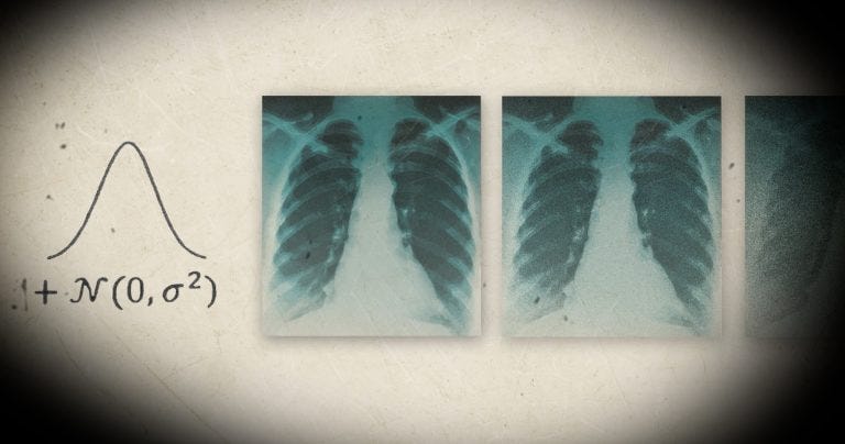 ROENTGEN-still