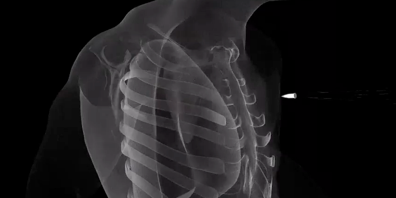 PolitiSage Resource: WaPo's Excellent "The Blast Effect"