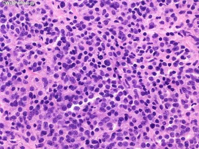 Microscope photo: Crowded field of dark spots against an almost uniform pink background. Microscope photo: Crowded field of dark spots against an almost uniform pink background.