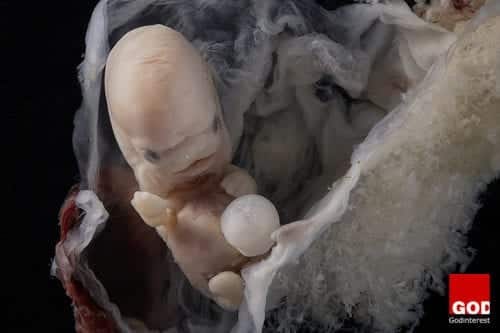 Embryo at approximately 7 weeks EGA from conception