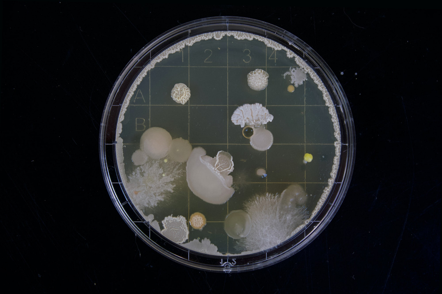 A friend of mine had to do some bacteria samples during her bachelor thesis. When i saw those i was instantly fascinated by the vast range of variation within this tiny microcosm. A friend of mine had to do some bacteria samples during her bachelor thesis. When i saw those i was instantly fascinated by the vast range of variation within this tiny microcosm.