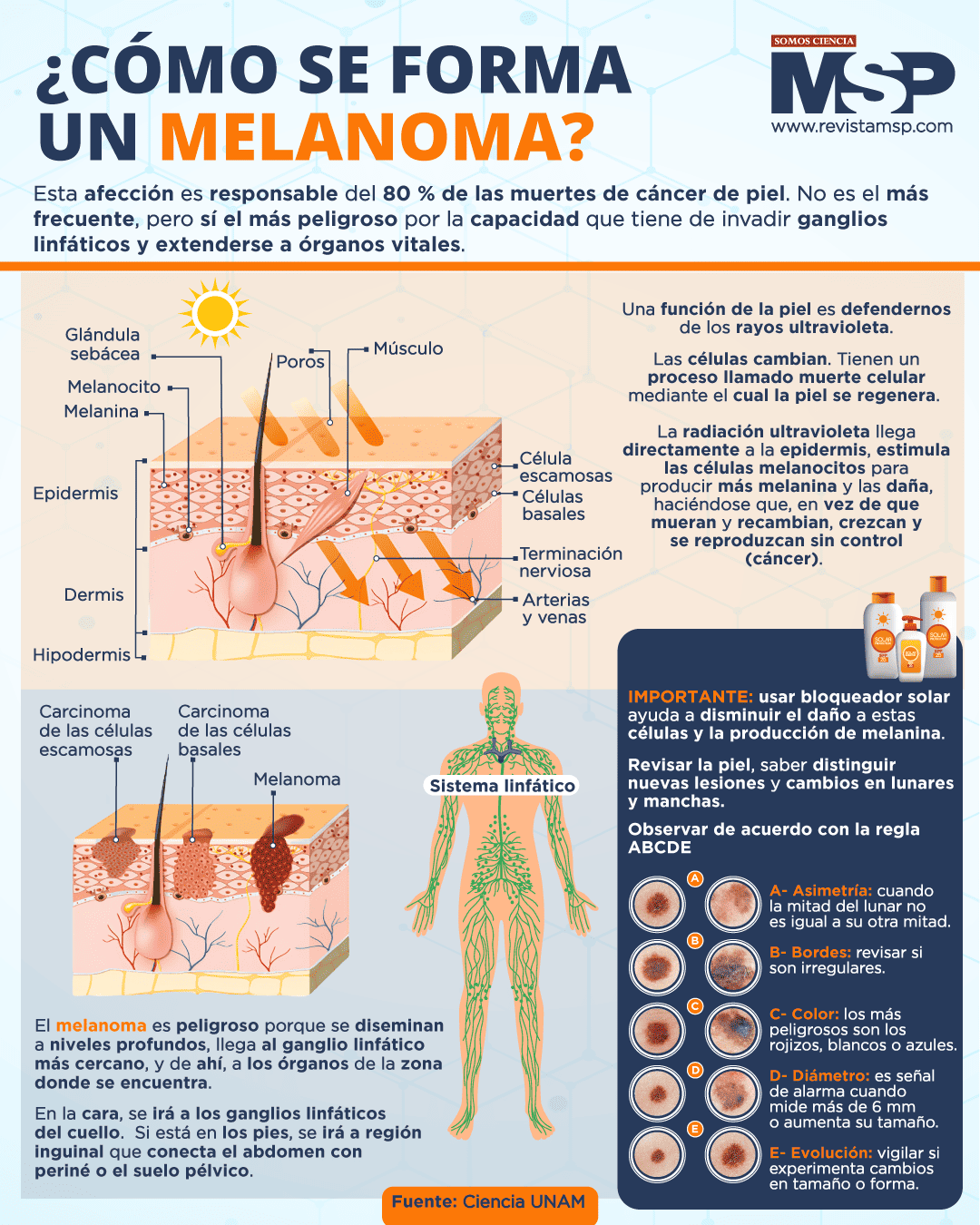 Cómo se forma un melanoma - Infografía