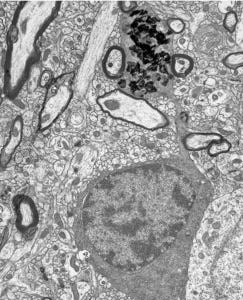 Alan Peter's oligodendrocyte EM Alan Peter's oligodendrocyte EM