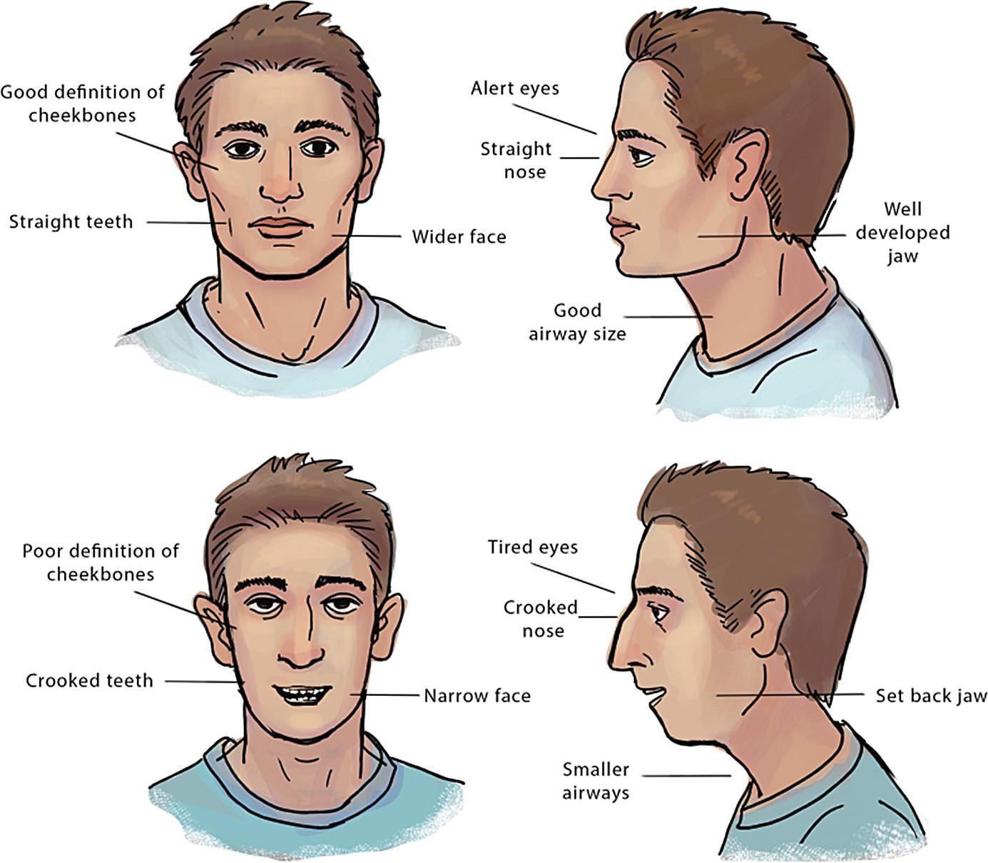 The Harmful Effects of Mouth Breathing - Coast Dental The Harmful Effects of Mouth Breathing - Coast Dental