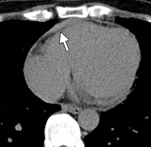 Figure 10a.