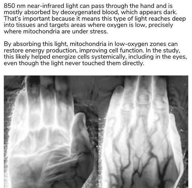 Ist möglicherweise ein Bild von Röntgenbild und Text „850 nm near-infrared light can pass through the hand and is mostly absorbed by deoxygenatec blood, which appears dark. That's important because it means this type of ight reaches deep into tissues and targets areas where oxygen is low, precisely where mitochondria are under stress. By absorbing this light, mitochondria in low-oxygen zones can restore energy production, improving cell function. In the study, this likely helped energize cells systemically, including in the eyes, even though the light never touched them directly.“