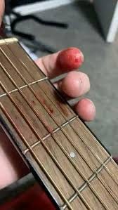 Them : “Play till you start bleeding ” Hell No, it's time to give up😿