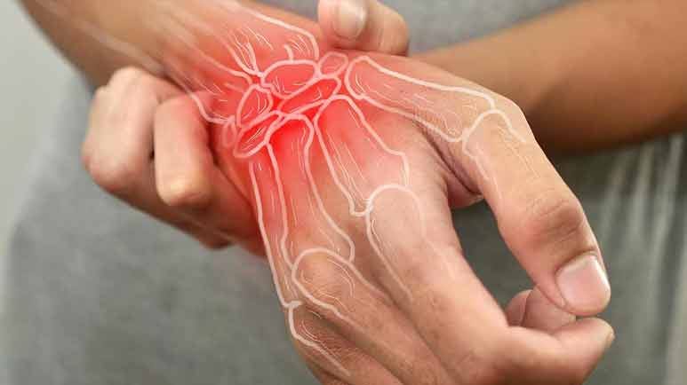 rheumatoid arthritis immune aging rheumatoid arthritis immune aging