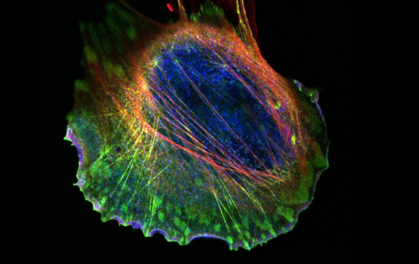 Meccanismi di migrazione delle cellule tumorali. Credit: IFOM. 