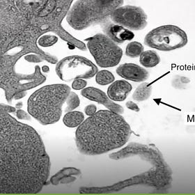 Perhaps The Most Important Work of Our Time: The Elusive "Virus", The Control Experiment, & Jamie Andrews 