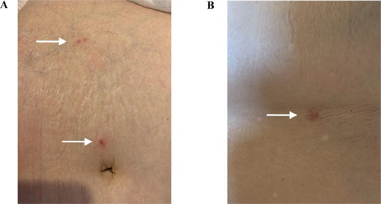 Figure 1 Figure 1