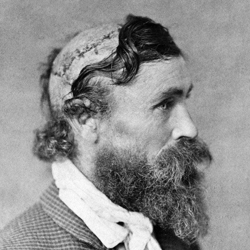 Robert McGee, scalped at 14 by Kiowa warriors in 1864, became a sideshow attraction for years after. Robert McGee, scalped at 14 by Kiowa warriors in 1864, became a sideshow attraction for years after.